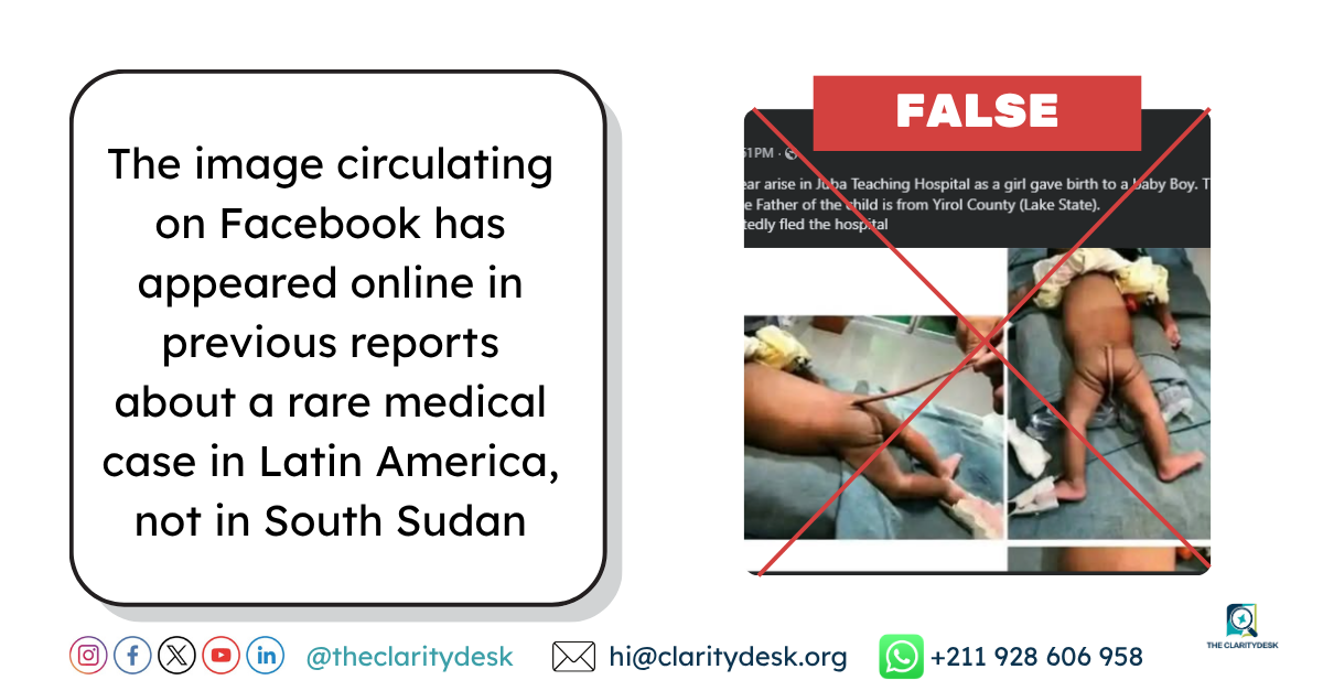 Photo-of-baby-allegedly-born-at-Juba-Teaching-Hospital-is-not-from-South-Sudan.png